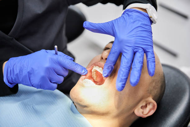 Best Emergency Root Canal Therapy in Wilson, OK
